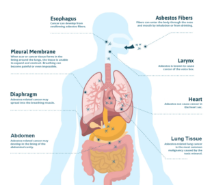 Why is Asbestos Awareness So Important? – Training Express