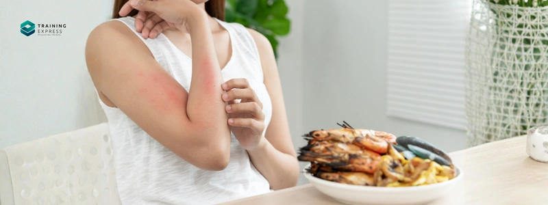 Food Allergen Awareness Training
